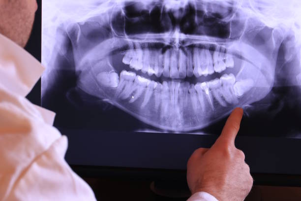 Best Emergency Dentist Open Today  in Montz, LA